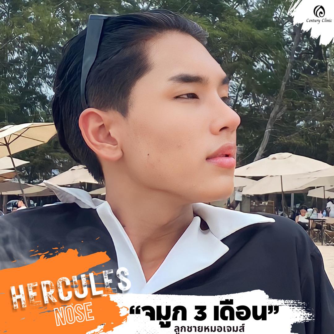 รีวิว แก้จมูก#858