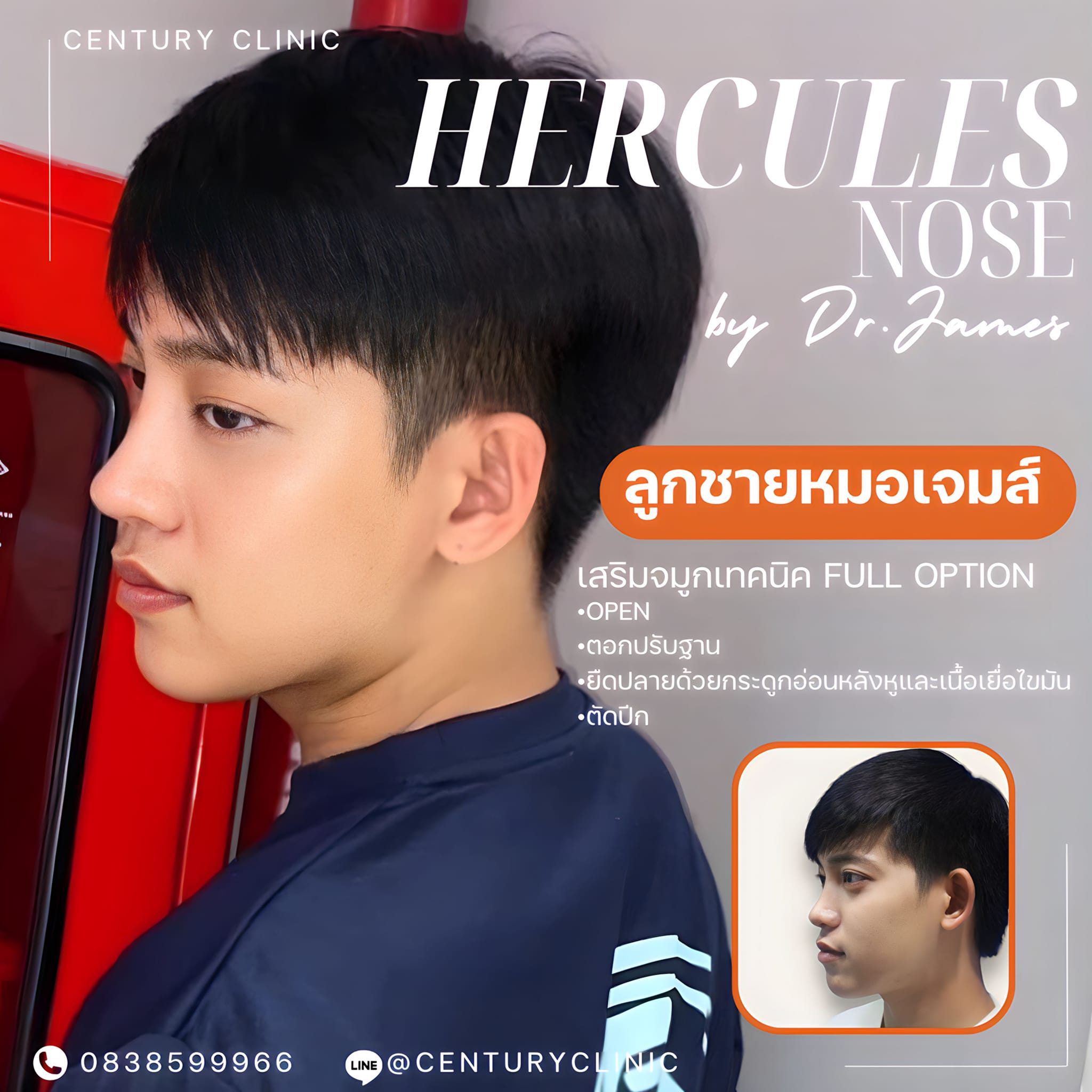 เสริม #902