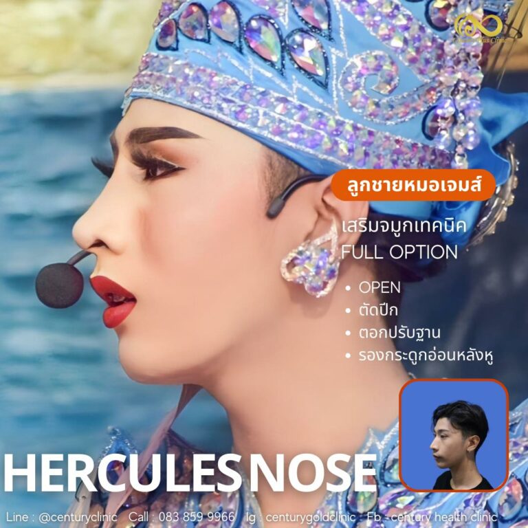 เสริมจมูก #909