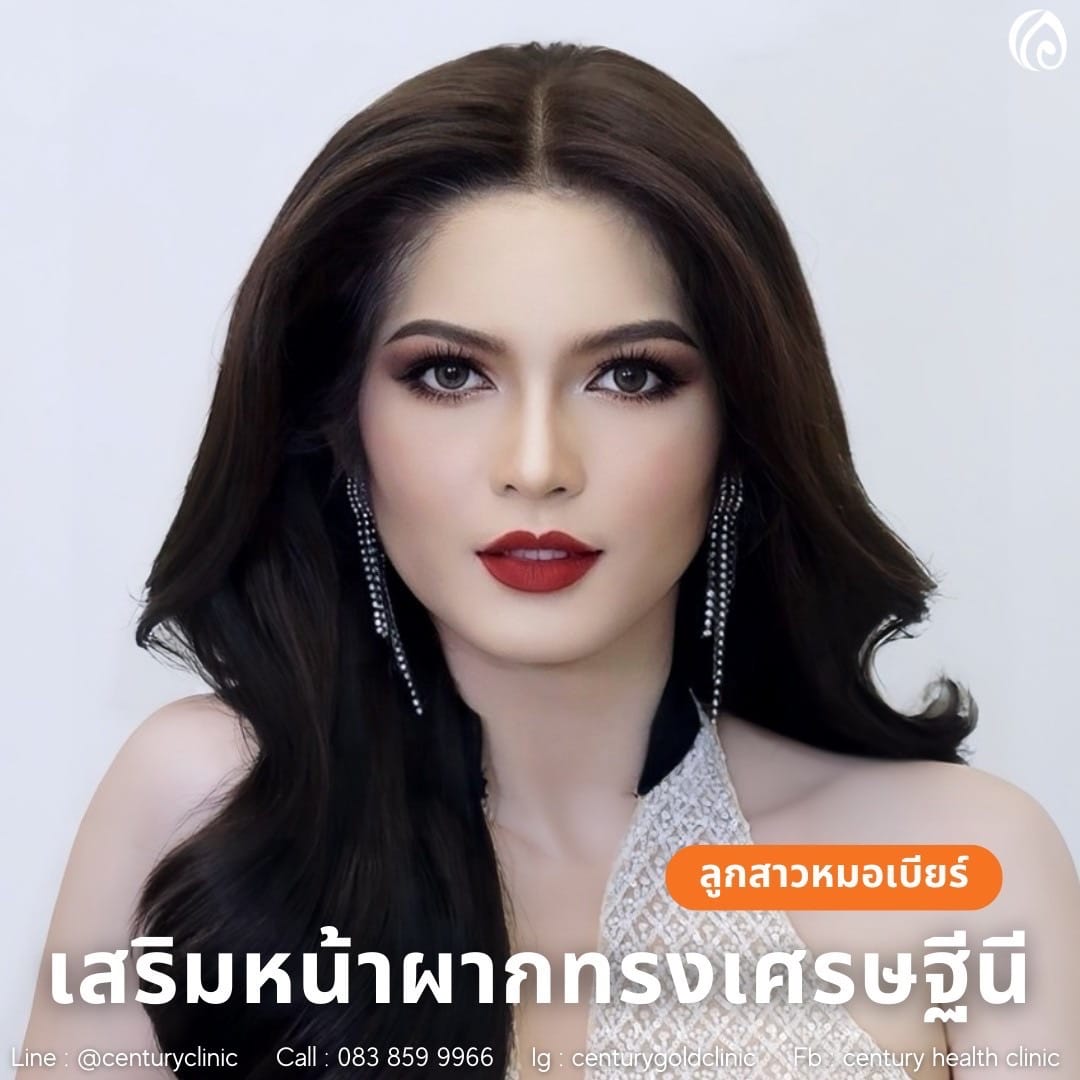 รีวิว เสริมหน้าผาก #37 , Century Clinic Thailand เสริมหน้าผาก #37
