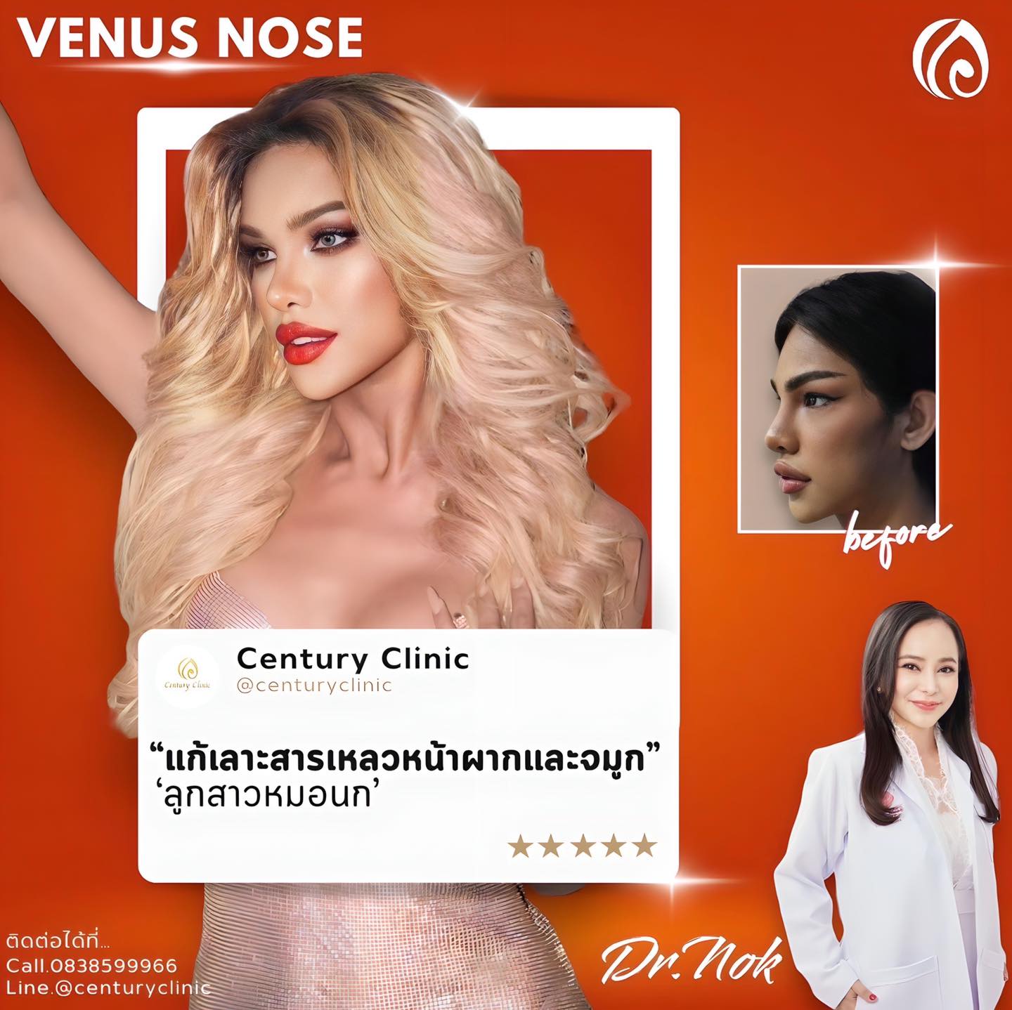 แก้จมูก #889