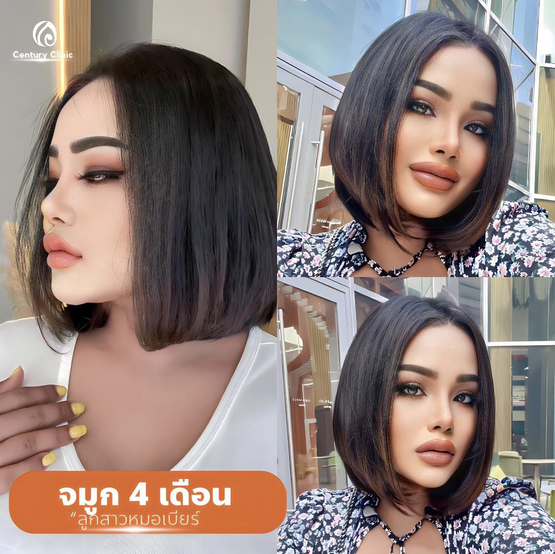 แก้จมูก #900