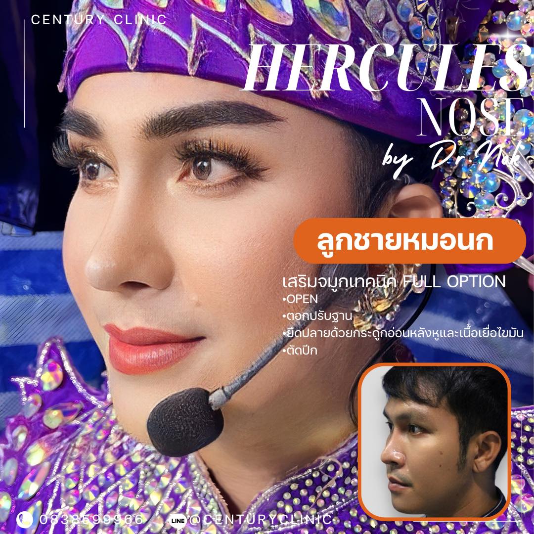 แก้จมูก #906