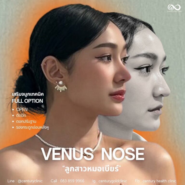 เสริมจมูก#924