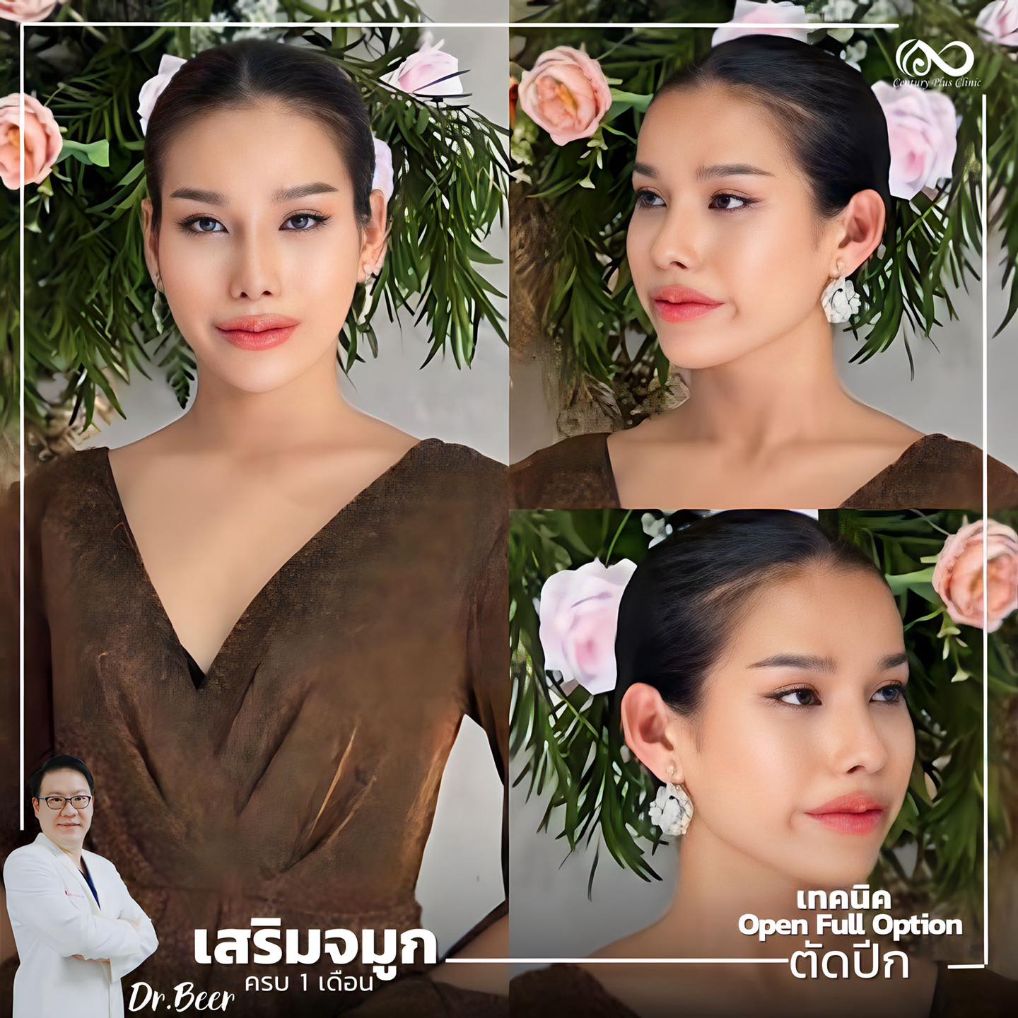 เสริมจมูก #1015