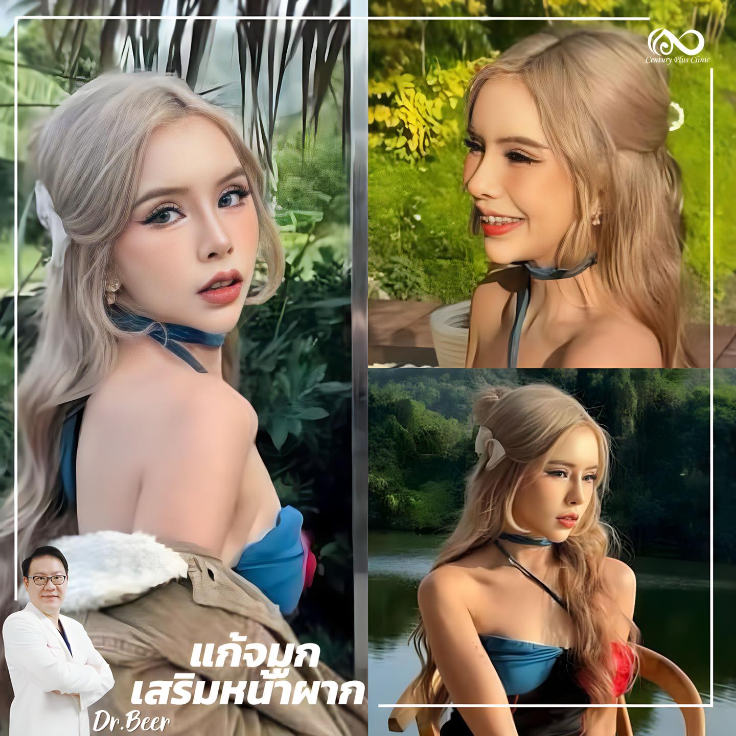 แก้จมูก #1001