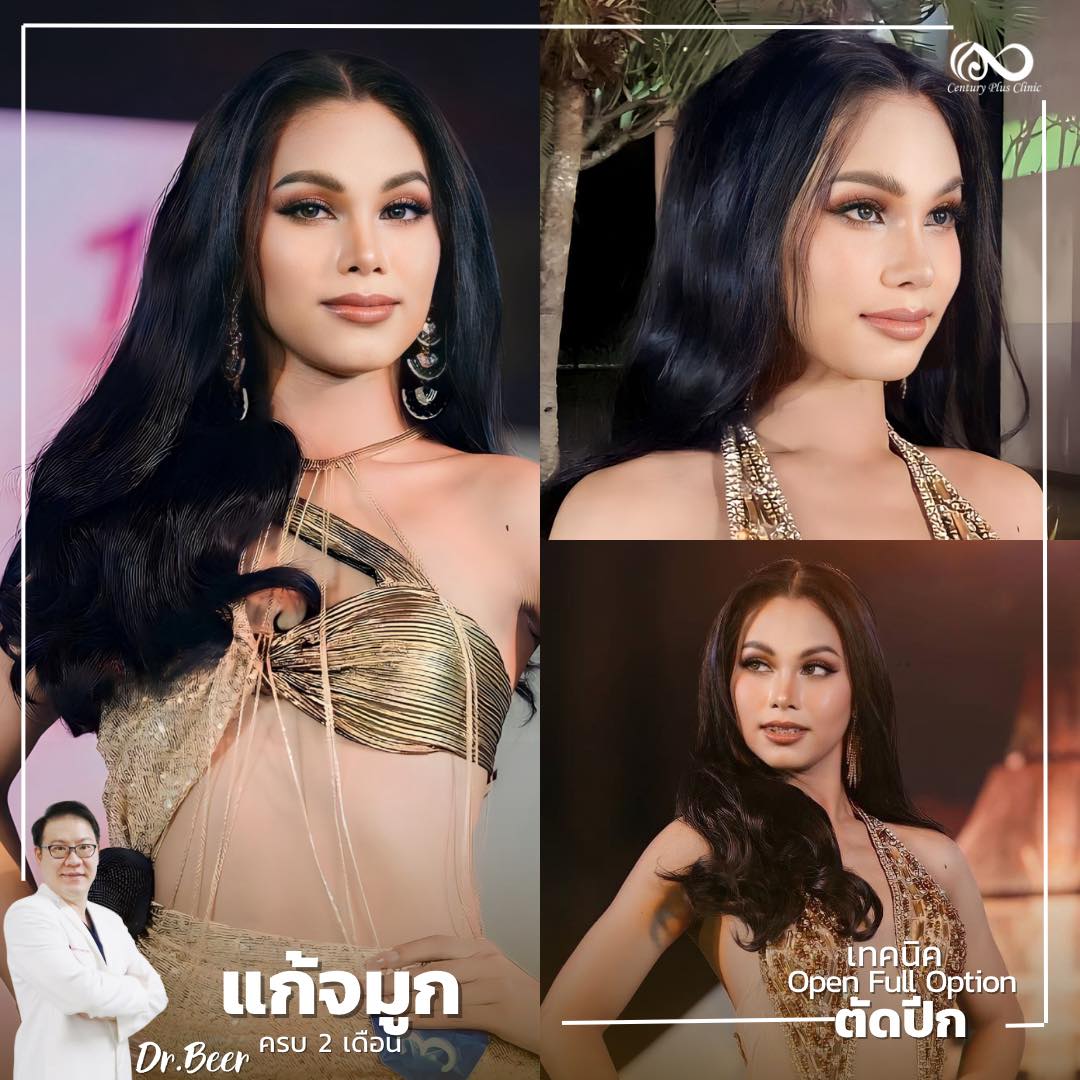 แก้จมูก #1006