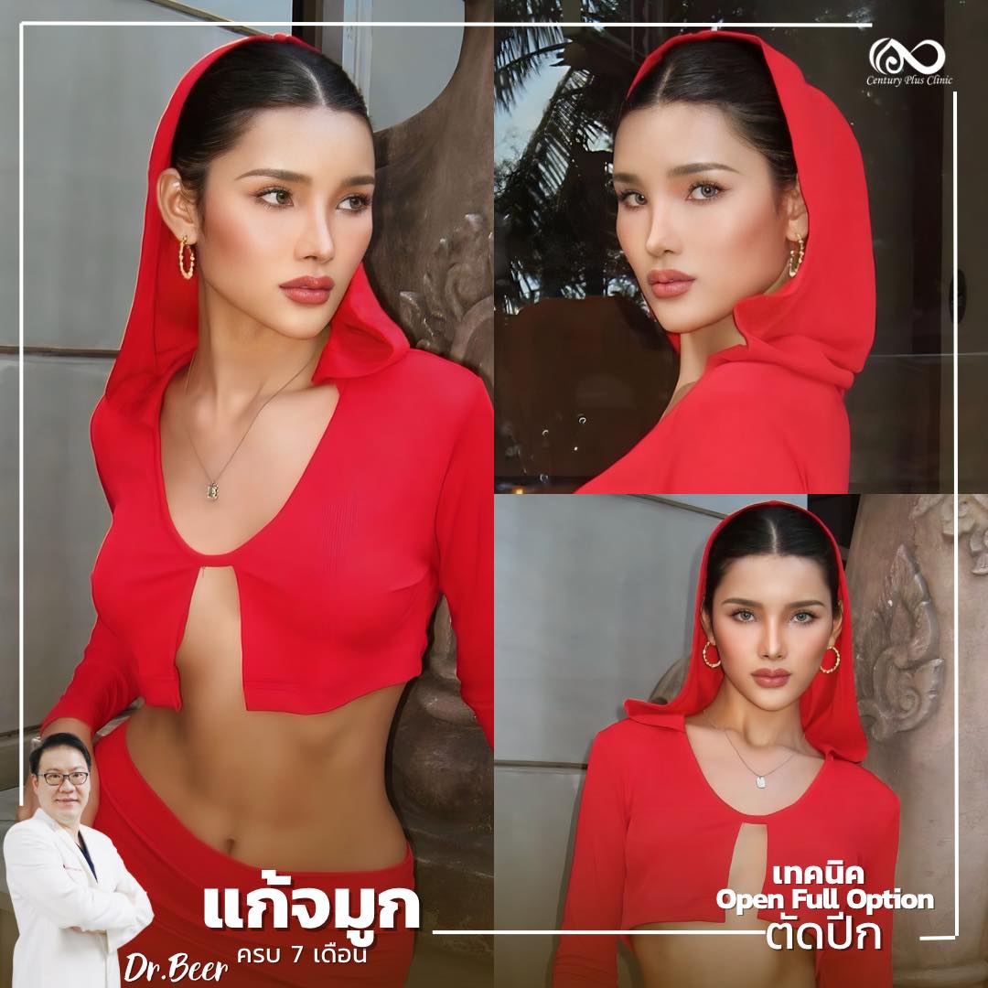 แก้จมูก #1008