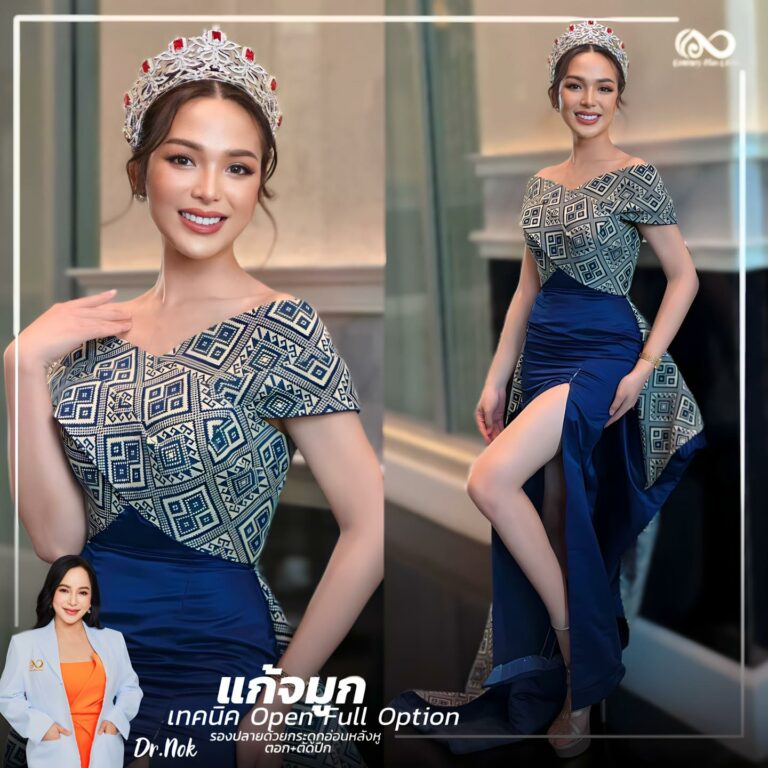 แก้จมูก #1040