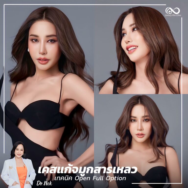 แก้จมูก #1042