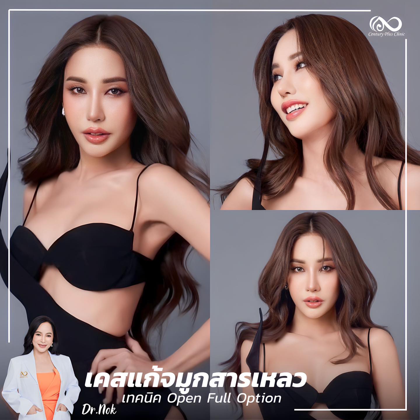 แก้จมูก #1042