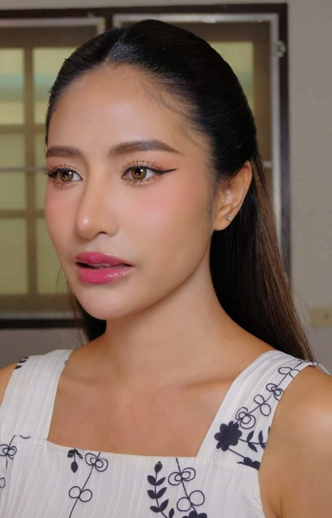 รีวิว แก้จมูก #1010 , Century Clinic Thailand แก้จมูก 2#1010