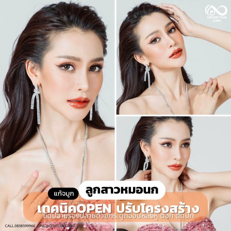 แก้จมูก #988