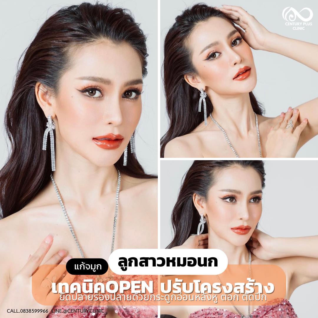 แก้จมูก #988
