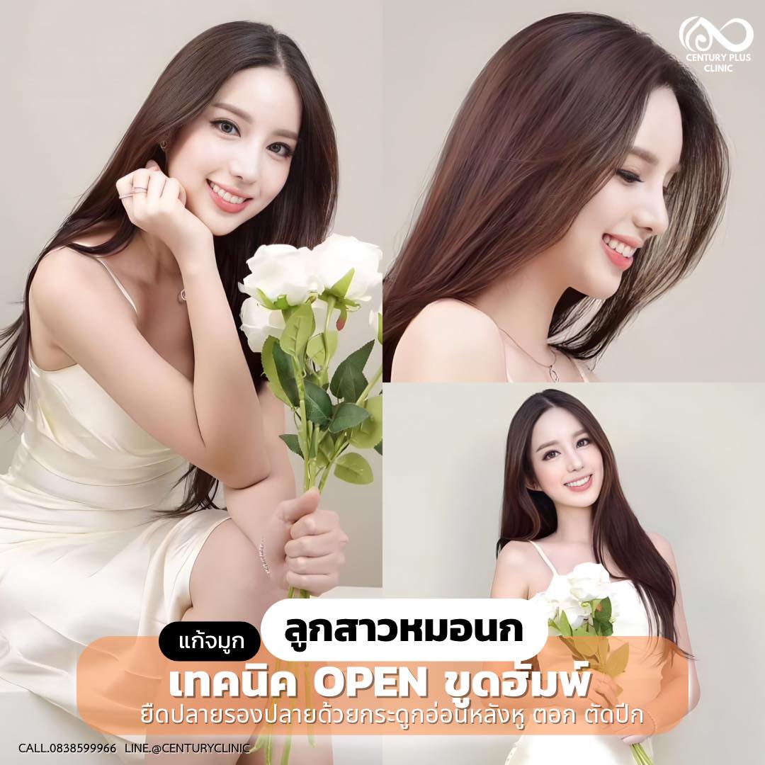 แก้จมูก #991