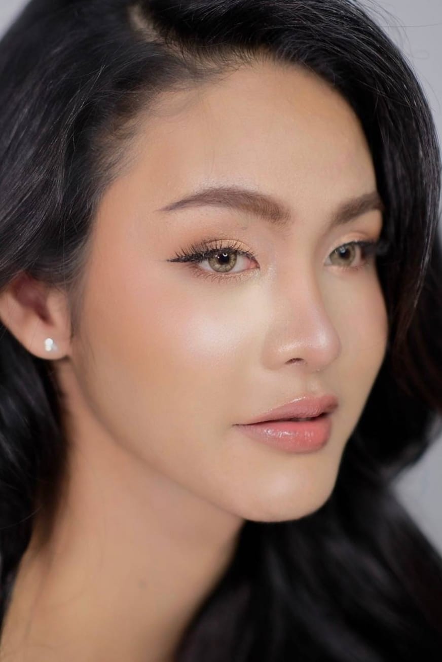 รีวิว เสริมจมูก #1129 , Century Clinic Thailand เสริมจมูก #1129