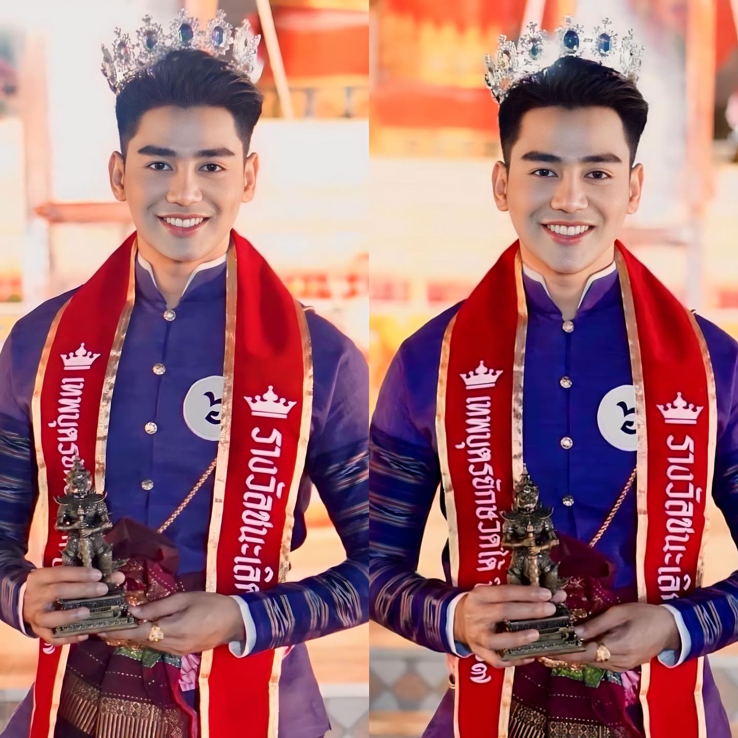 รีวิว เสริมจมูก #1131 , Century Clinic Thailand เสริมจมูก #1131