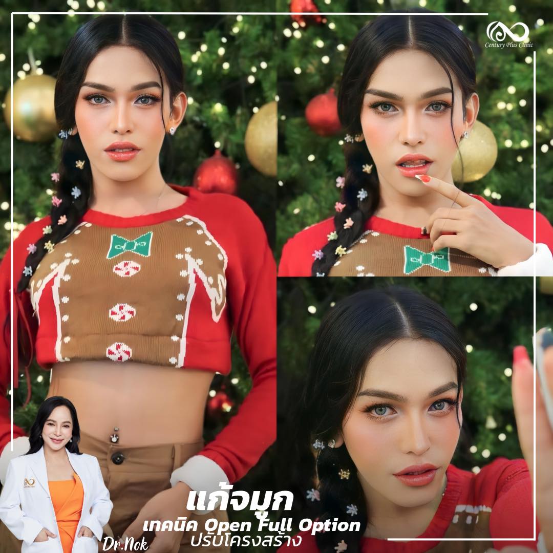 แก้จมูก #1051