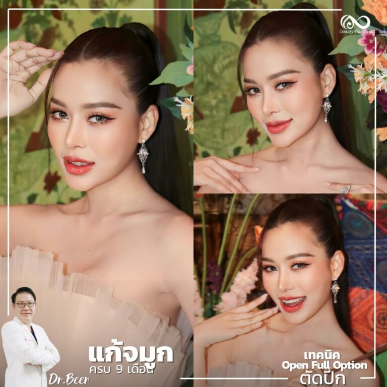 แก้จมูก #1068