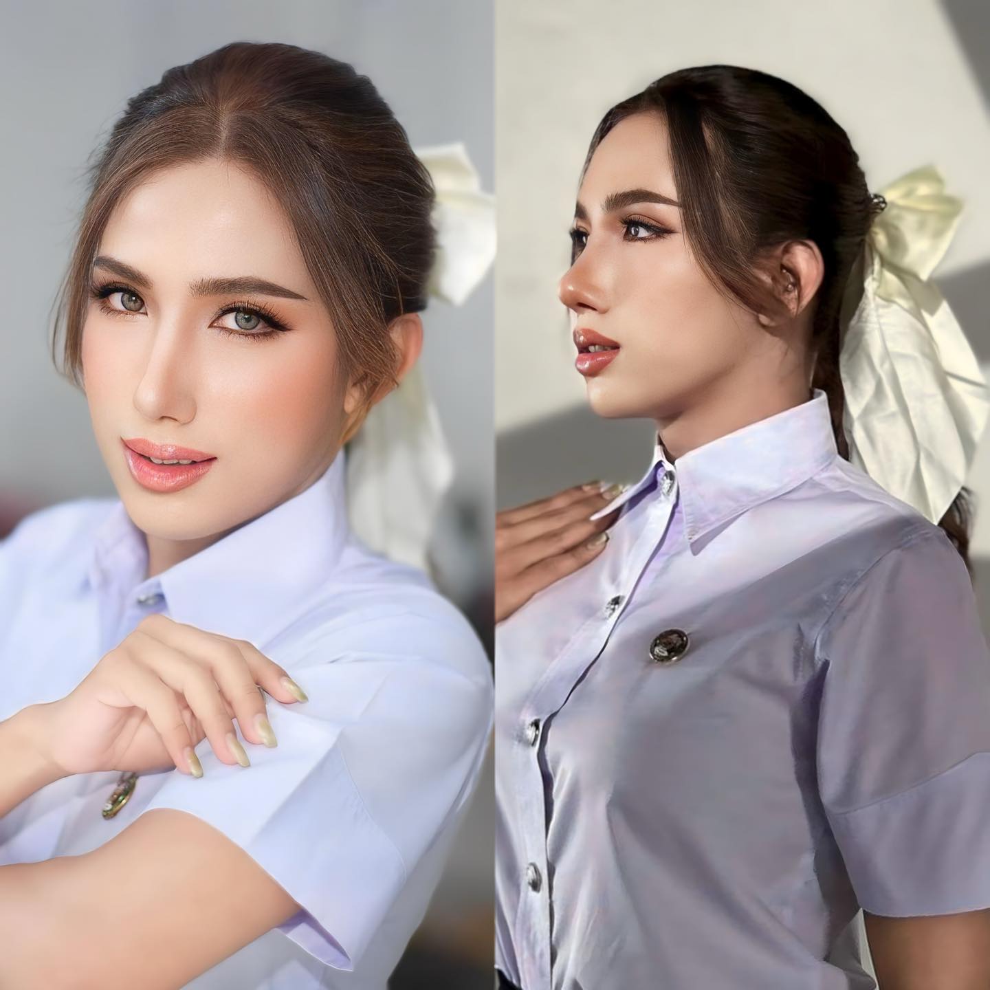 รีวิว แก้จมูก #1100 , Century Clinic Thailand แก้จมูก #1100