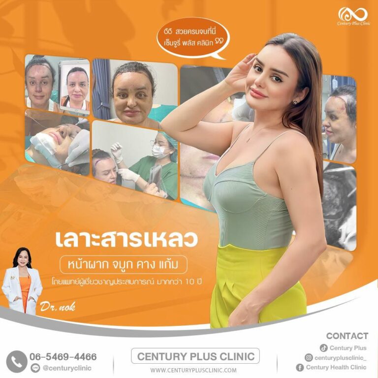 แก้จมูก #1122