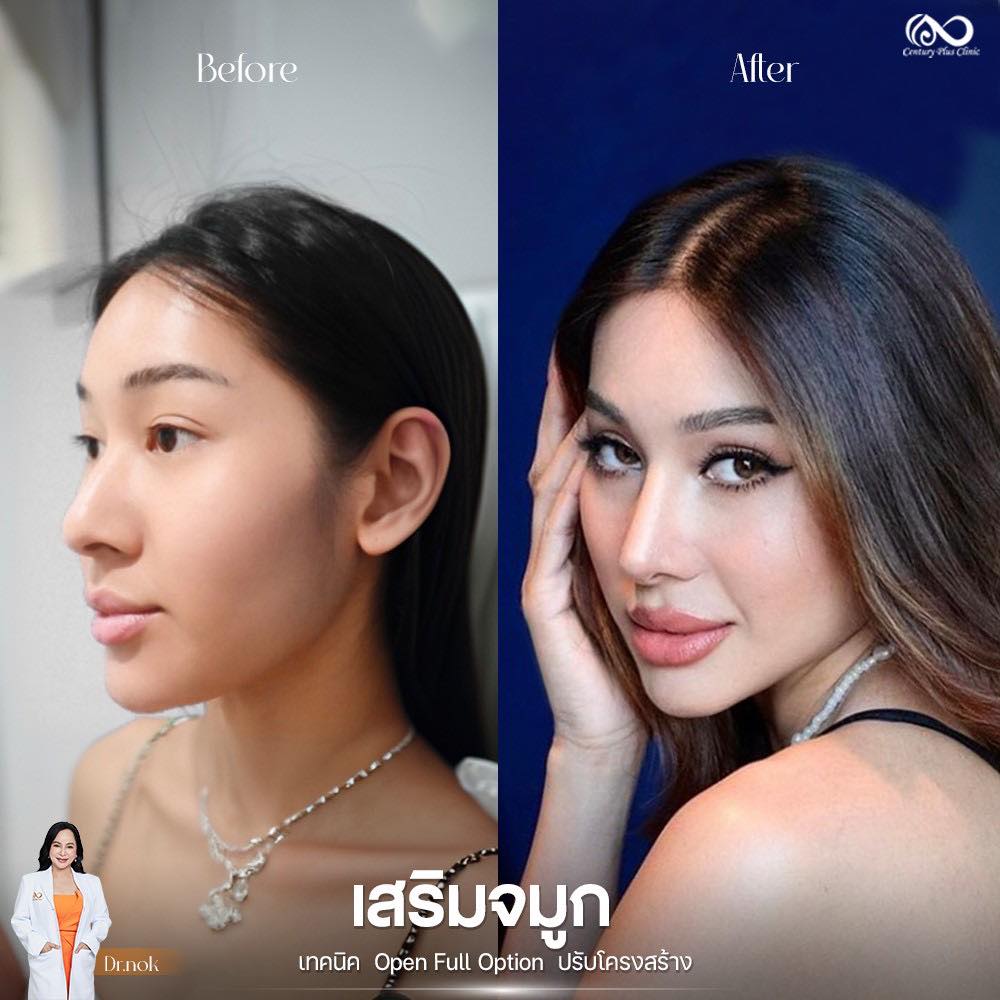Century Clinic Thailand