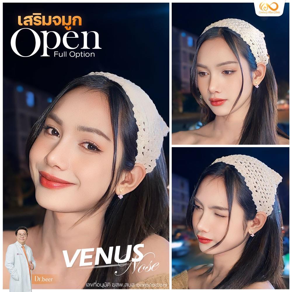 รีวิว เสริมจมูก #1209 , Century Clinic Thailand เสริมจมูก #1209