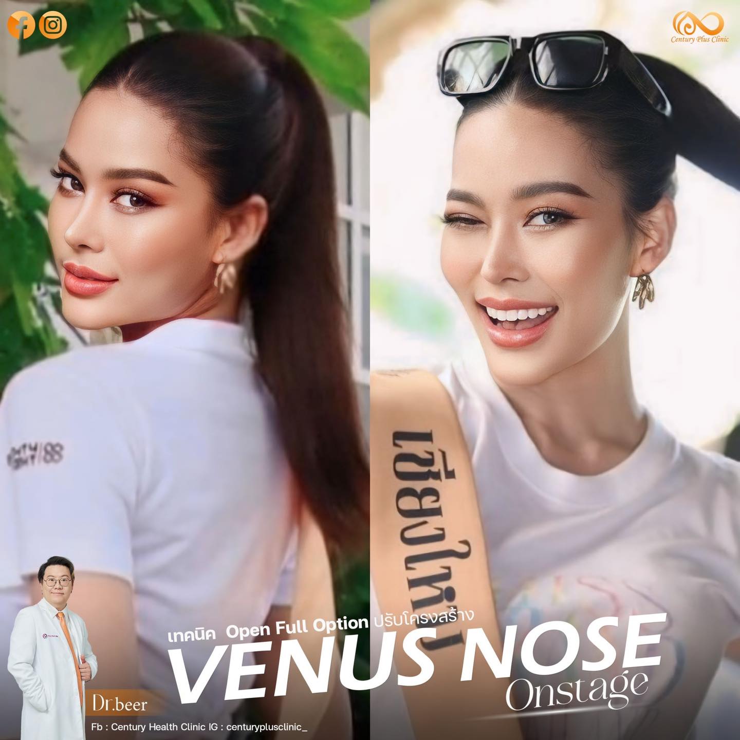 รีวิว แก้จมูก #1224 , Century Clinic Thailand แก้จมูก #1224