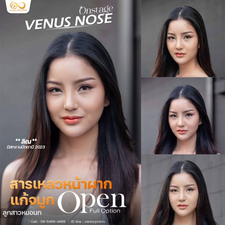 แก้จมูก #1247
