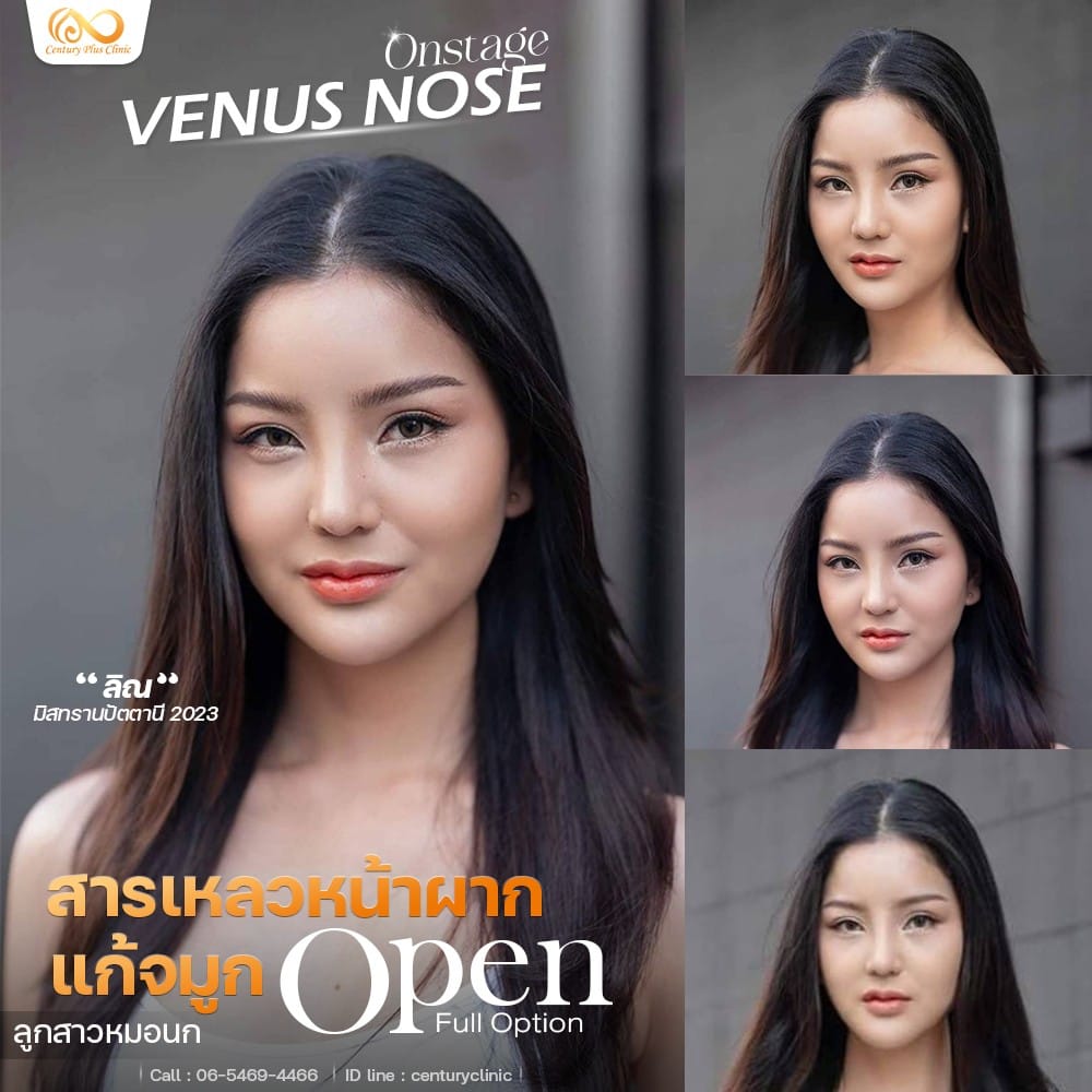 แก้จมูก #1247