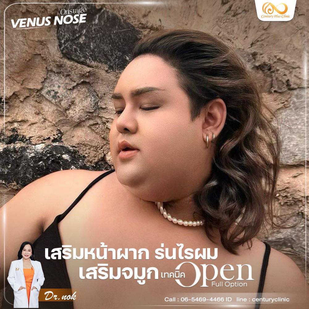 รีวิว เสริมจมูก #1252 , Century Clinic Thailand เสริมจมูก 1#1252