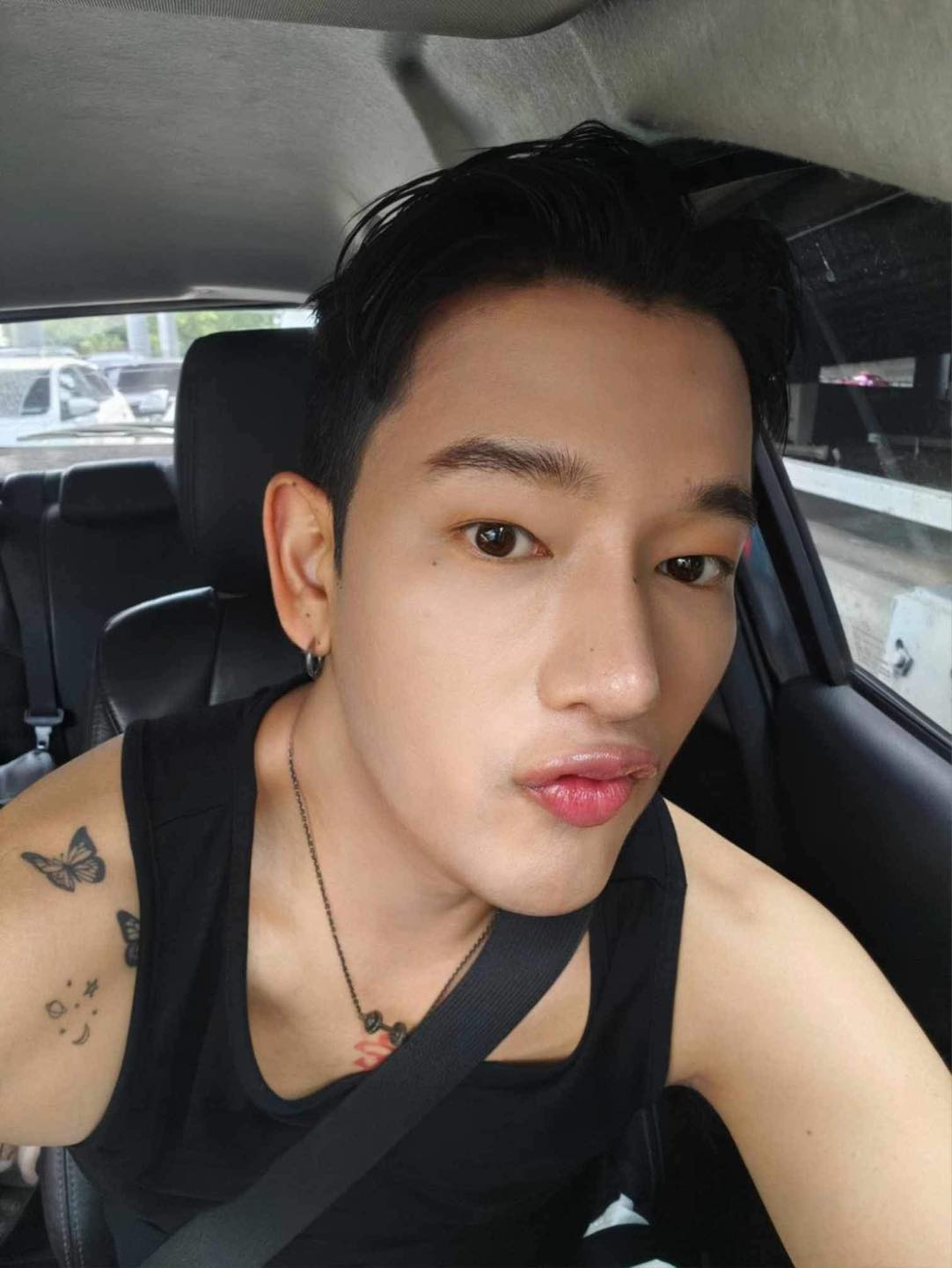 รีวิว แก้จมูก #1271 , Century Clinic Thailand แก้จมูก #1271
