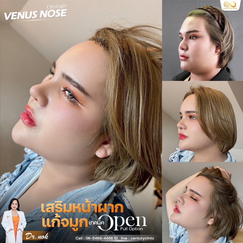 แก้จมูก #1273