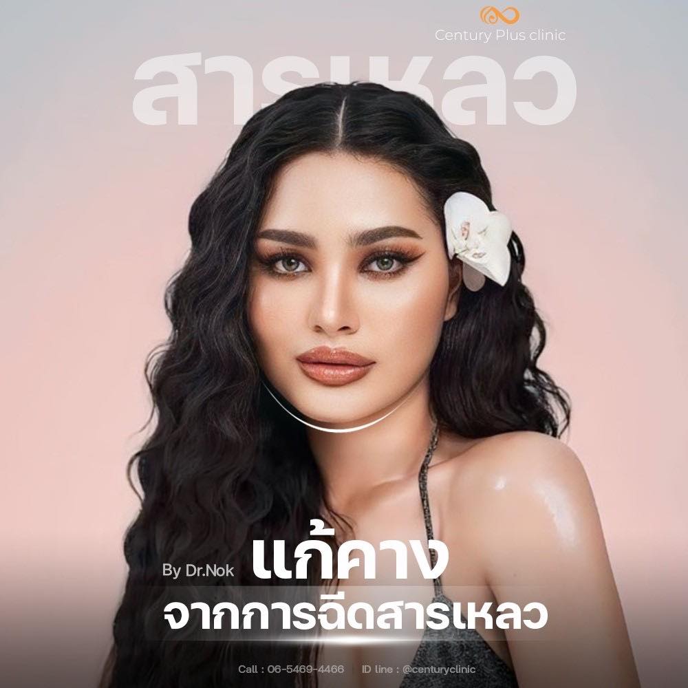 รีวิว เสริมคาง #11 , Century Clinic Thailand Review เสริมคาง #11