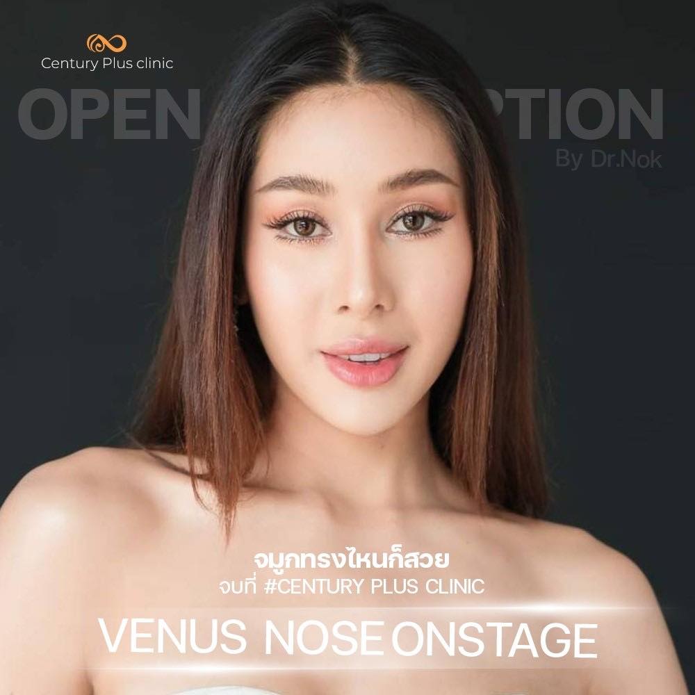 เสริมจมูก 1#1363
