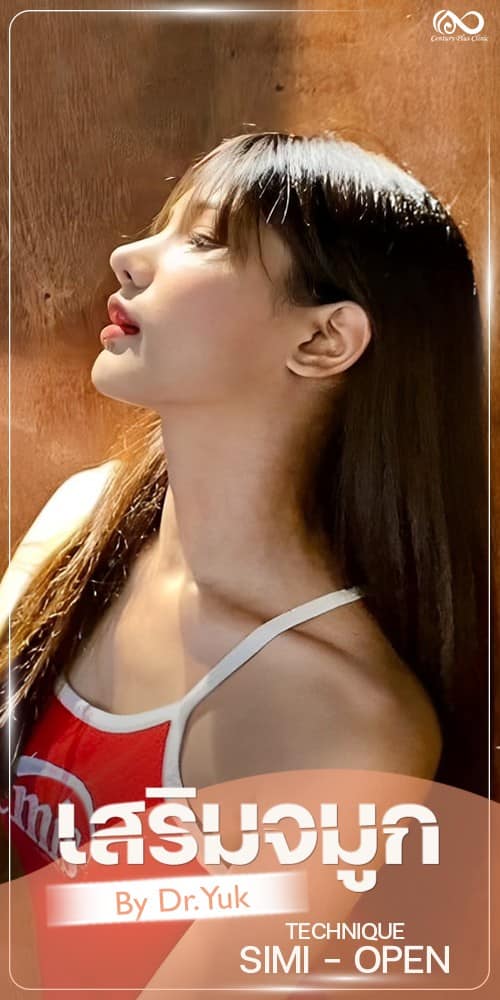เสริมจมูก #1323