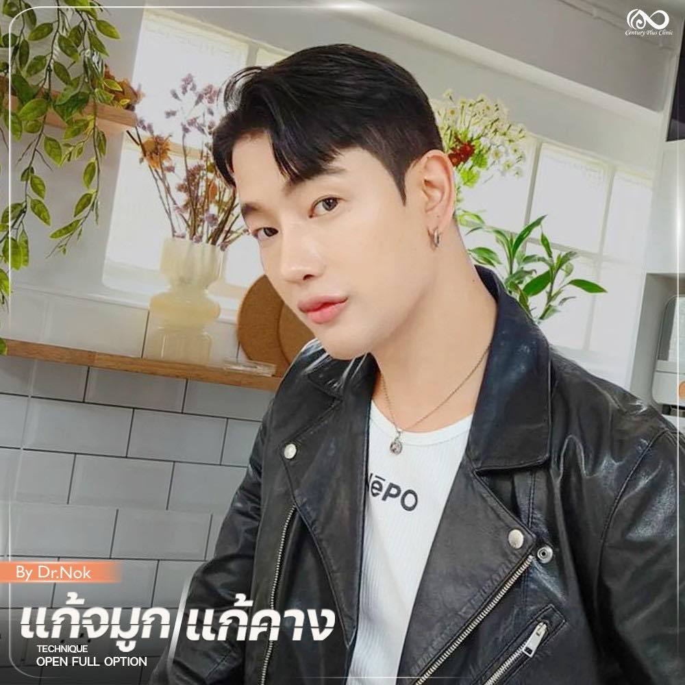 แก้จมูก 1#1312
