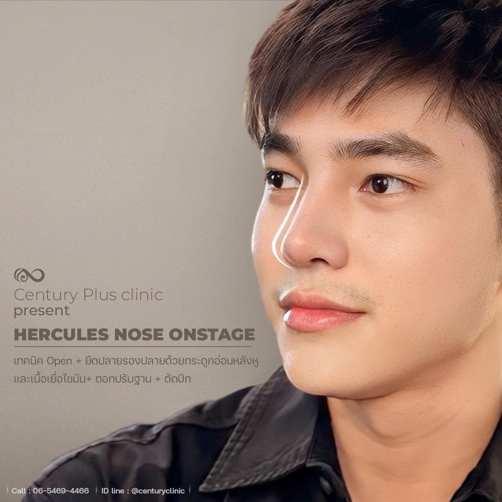 รีวิว แก้จมูก #1340 , Century Clinic Thailand แก้จมูก #1340