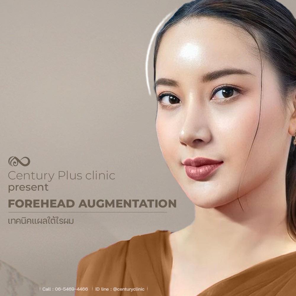 รีวิว แก้จมูก #1345 , Century Clinic Thailand แก้จมูก #1345