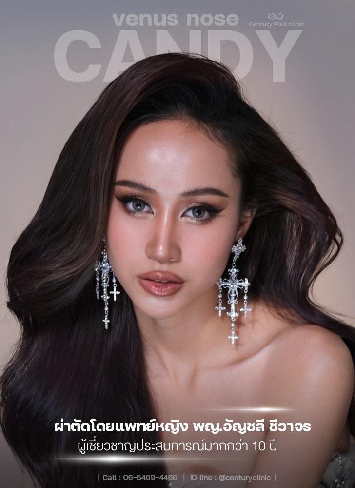เสริมจมูก 1#1373
