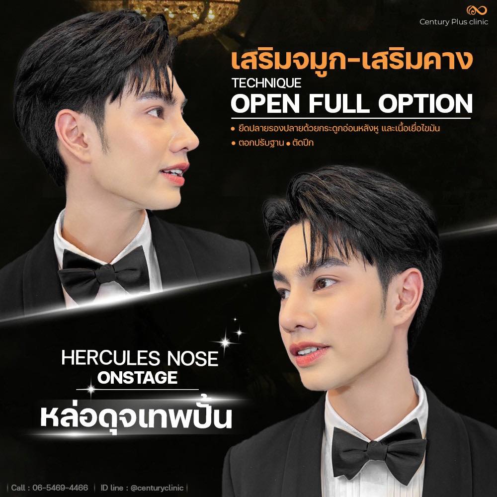 รีวิว เสริมจมูก #1371 , Century Clinic Thailand เสริมจมูก #1371