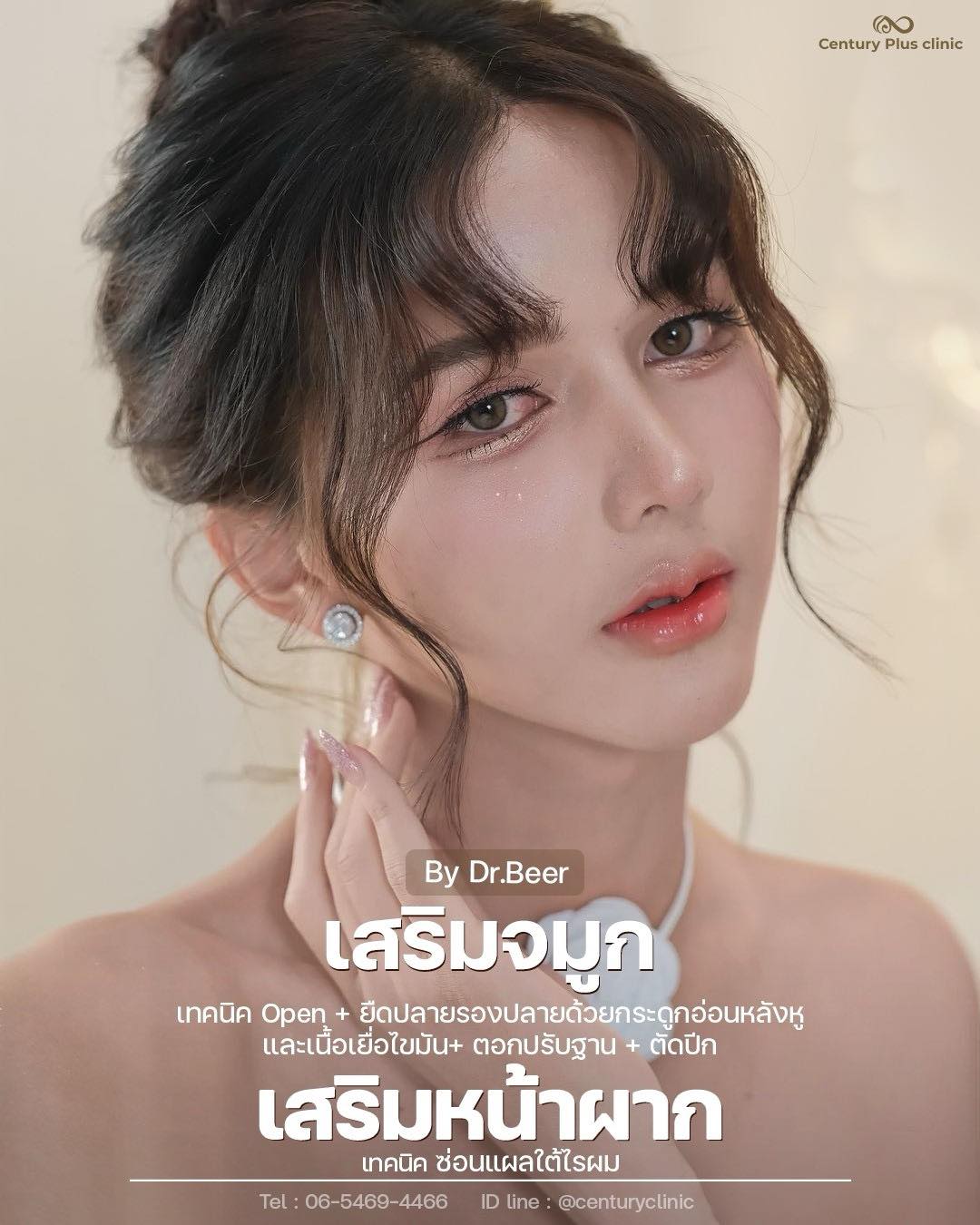 รีวิว เสริมจมูก #1384 , Century Clinic Thailand เสริมจมูก #1384