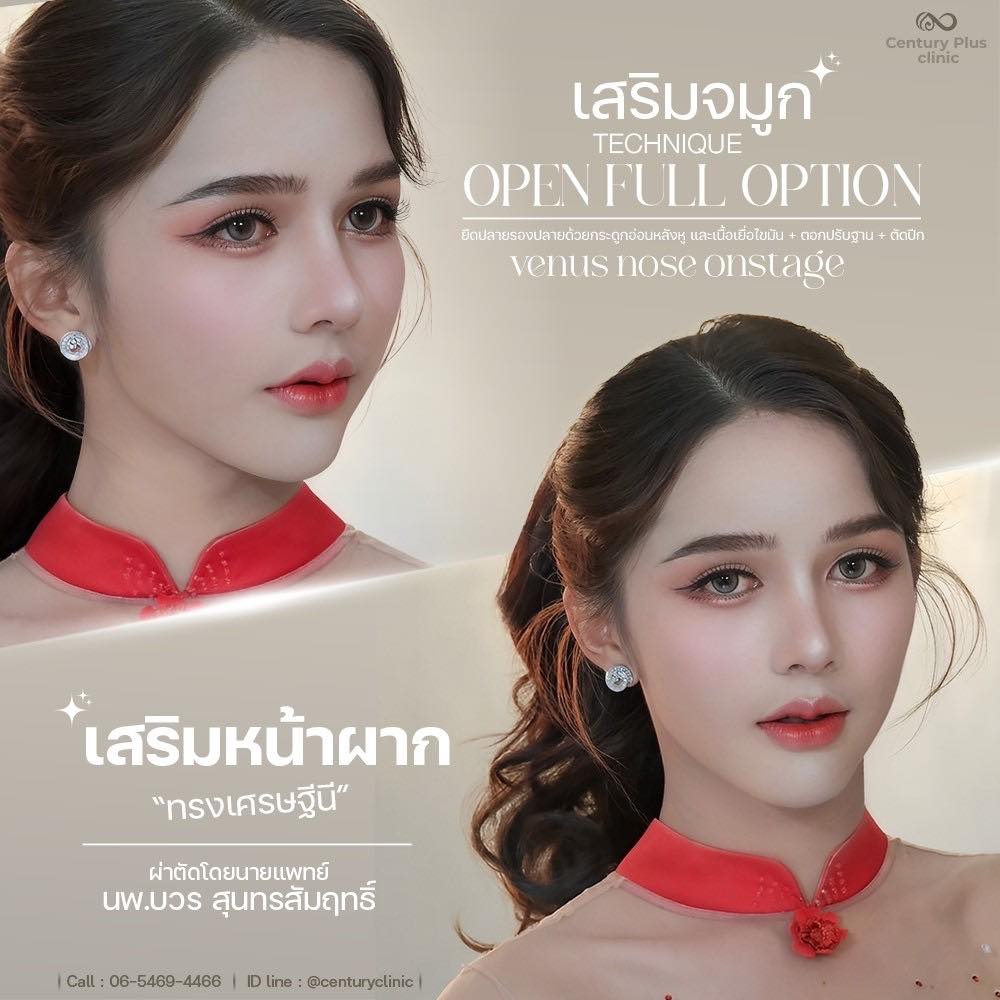 รีวิว เสริมจมูก #1397 , Century Clinic Thailand เสริมจมูก #1397