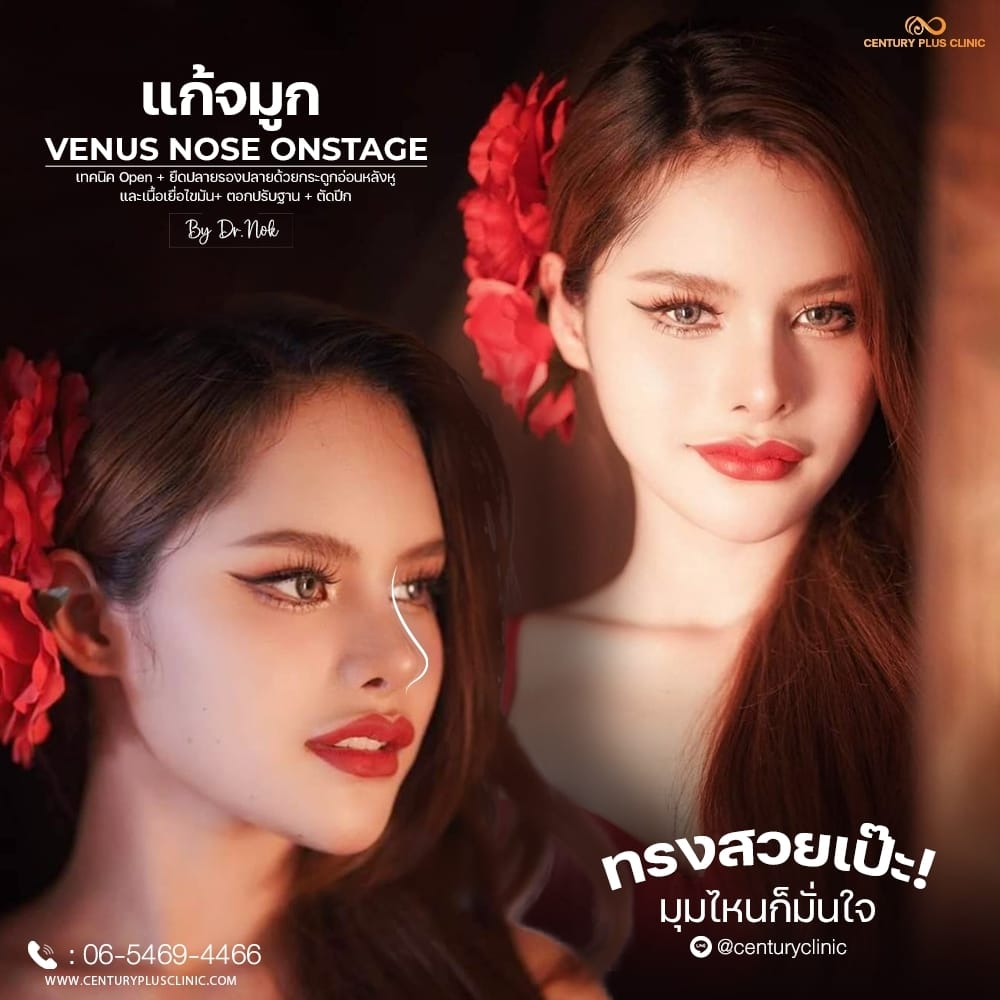 รีวิว แก้จมูก #1410 , Century Clinic Thailand แก้จมูก #1410