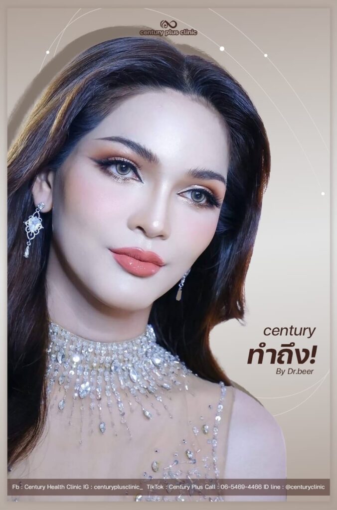 รีวิว เสริมหน้าผาก #48 , Century Clinic Thailand เสริมหน้าผาก 2#48