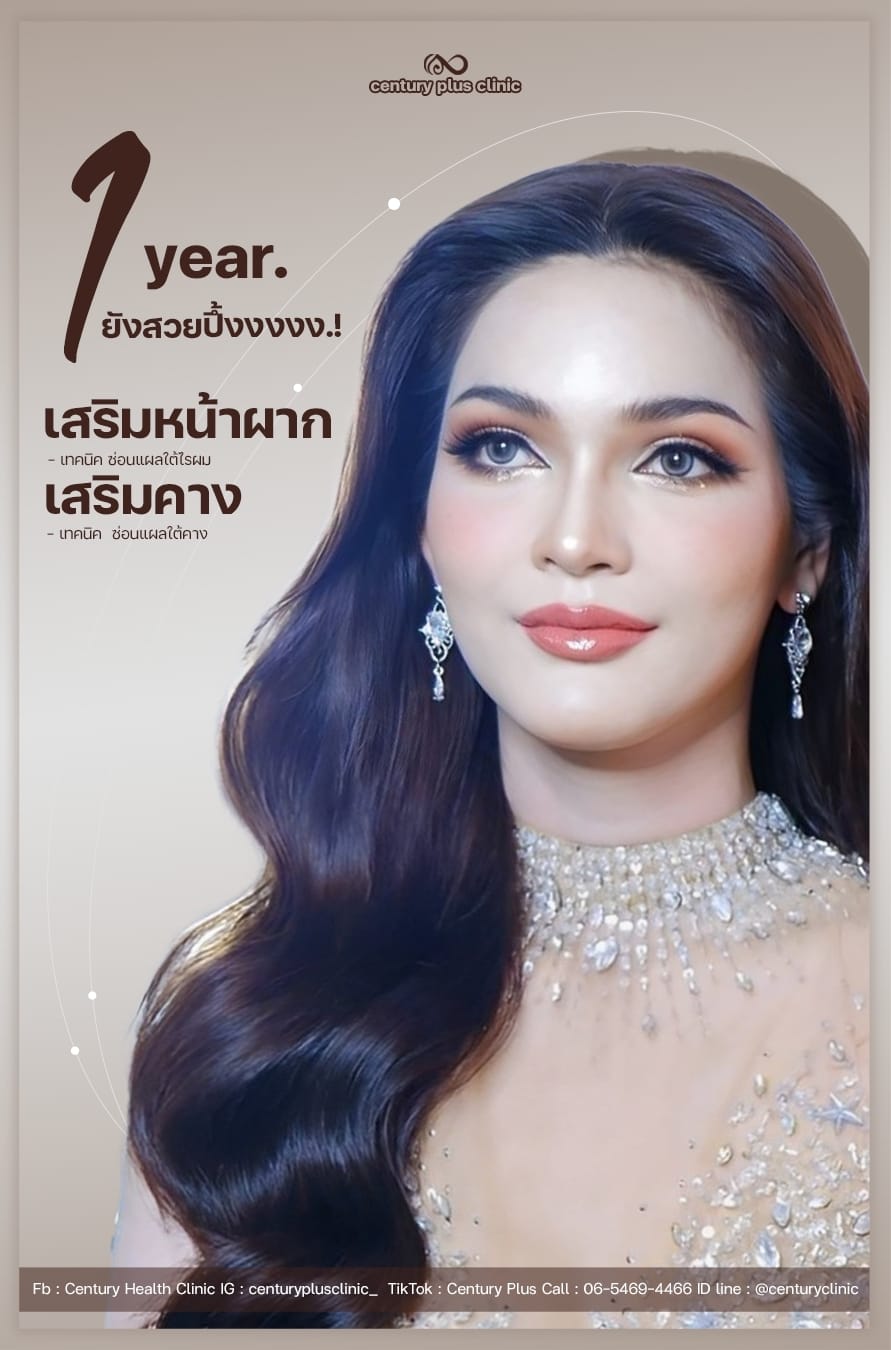 รีวิว เสริมหน้าผาก #48 , Century Clinic Thailand เสริมหน้าผาก #48