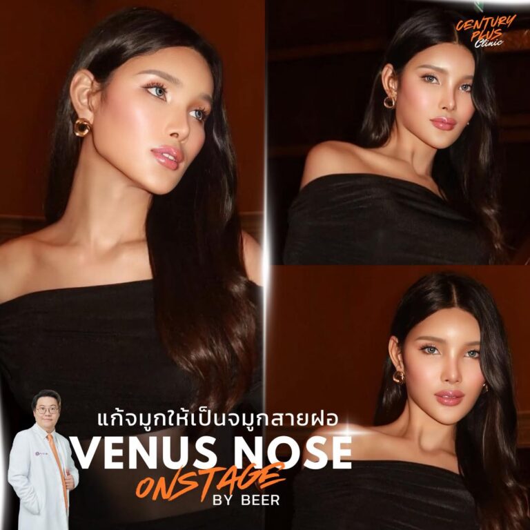 รีวิว แก้จมูก #1415 , Century Clinic Thailand แก้จมูก #1414